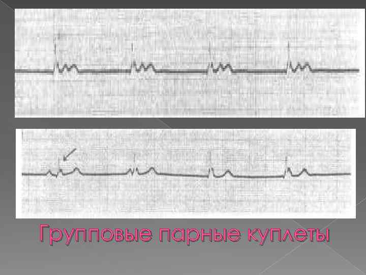 Групповые парные куплеты 