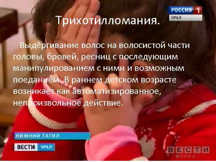 Трихотилломания. Выдёргивание волос на волосистой части головы, бровей, ресниц с последующим манипулированием с ними