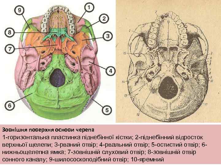 Зовнішня поверхня основи черепа 1 -горизонтальна пластинка піднебінної кістки; 2 -піднебінний відросток верхньої щелепи;