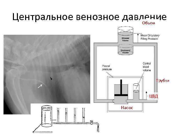 Центральное венозное давление Объем Трубки ЦВД Насос 