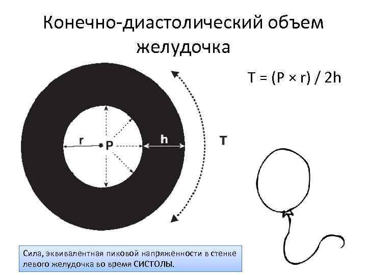 Конечно-диастолический объем желудочка T = (P × r) / 2 h Сила, эквивалентная пиковой