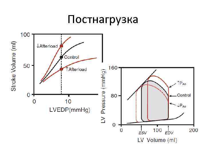 Постнагрузка 