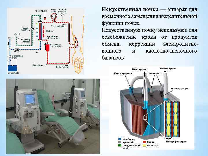 Искусственная почка презентация