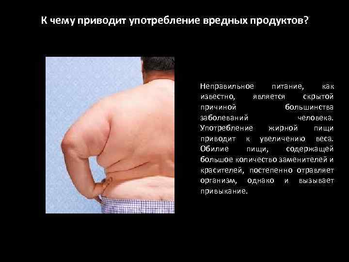 К чему приводит употребление вредных продуктов? Неправильное питание, как известно, является скрытой причиной большинства