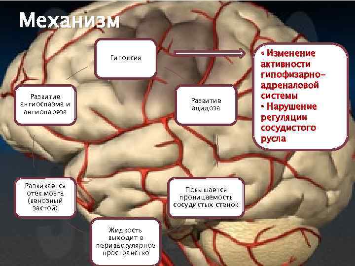 Отек мозга симптомы причины. Отек мозга этиология. Отек мозга механизм развития. Отек головного мозга патогенез. Вазогенный отек мозга.