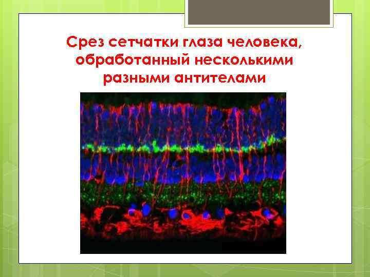 Срез сетчатки глаза человека, обработанный несколькими разными антителами 