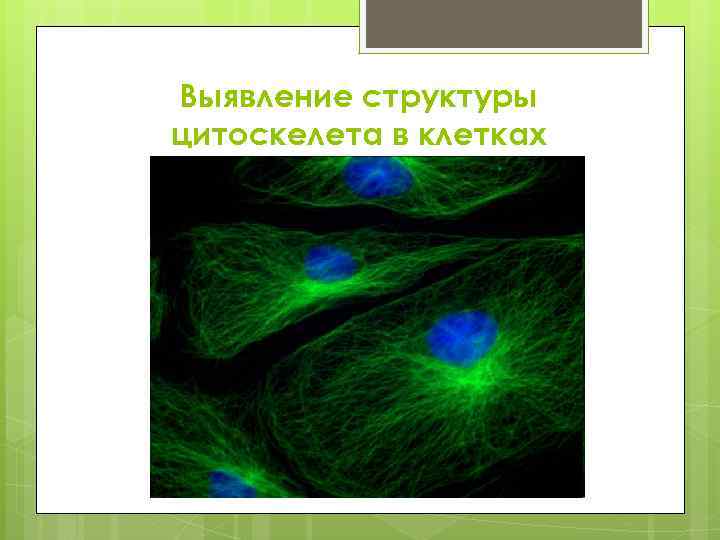 Выявление структуры цитоскелета в клетках 