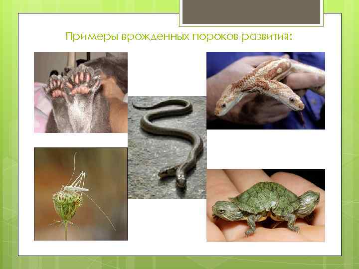 Примеры врожденных пороков развития: 