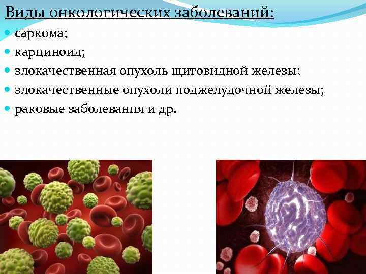 Виды онкологических заболеваний: саркома; карциноид; злокачественная опухоль щитовидной железы; злокачественные опухоли поджелудочной железы; раковые