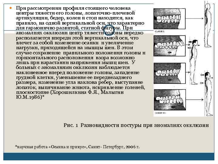  При рассмотрении профиля стоящего человека центры тяжести его головы, лопаточно плечевой артикуляции, бедер,