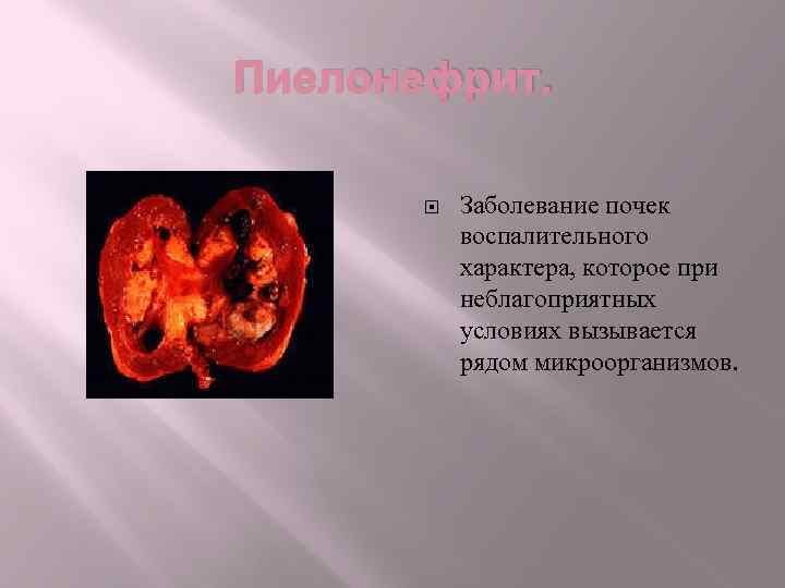 Пиелонефрит. Заболевание почек воспалительного характера, которое при неблагоприятных условиях вызывается рядом микроорганизмов. 