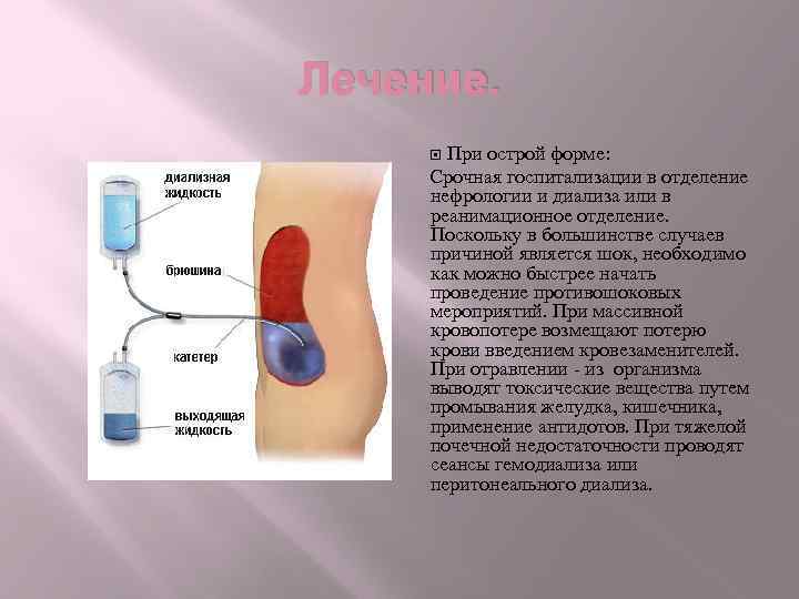 Болезни мочевыделительной системы презентация