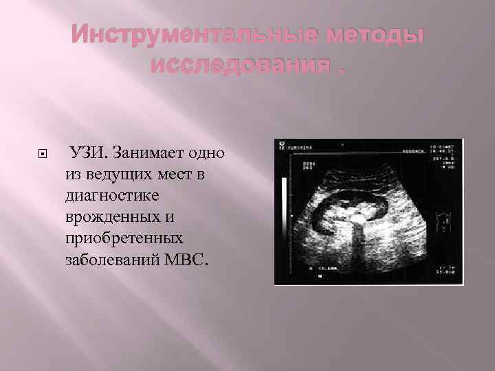 Инструментальные методы исследования. УЗИ. Занимает одно из ведущих мест в диагностике врожденных и приобретенных
