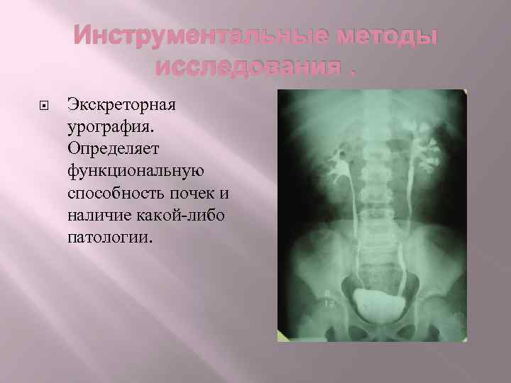 Инструментальные методы исследования. Экскреторная урография. Определяет функциональную способность почек и наличие какой-либо патологии. 