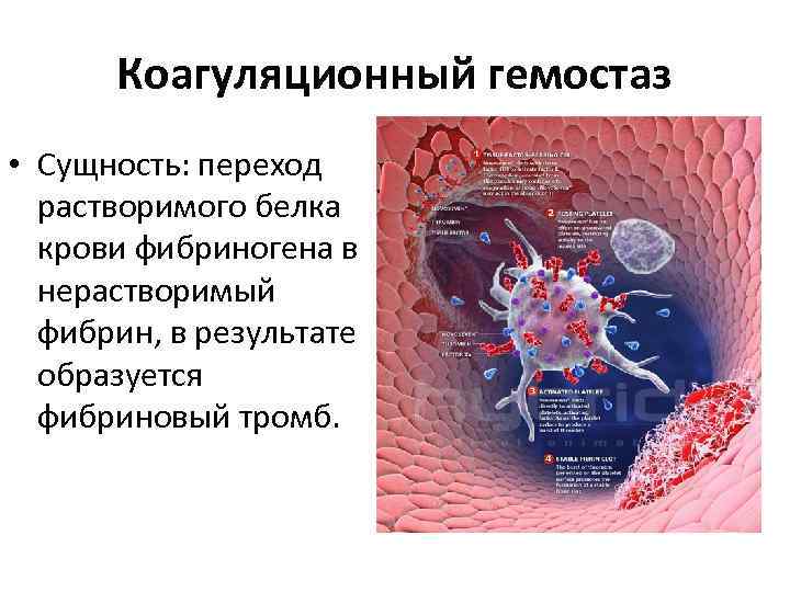 Коагуляционный гемостаз • Сущность: переход растворимого белка крови фибриногена в нерастворимый фибрин, в результате