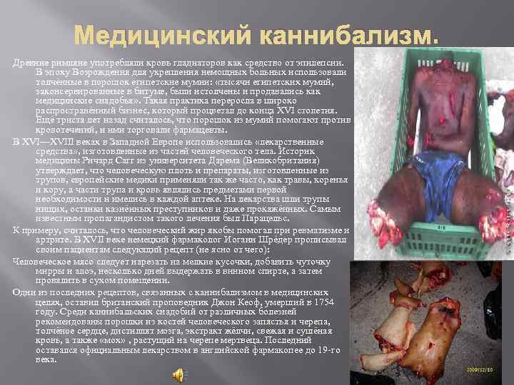Медицинский каннибализм. Древние римляне употребляли кровь гладиаторов как средство от эпилепсии. В эпоху Возрождения