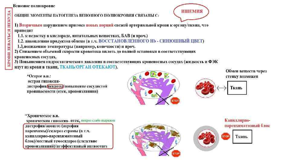 На схеме определите вид нарушения кровообращения