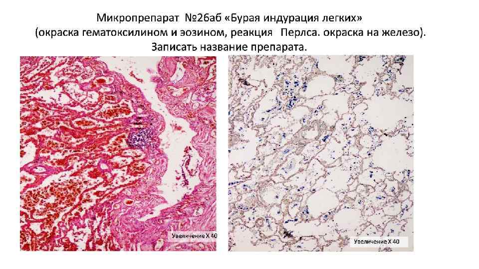 Патология кровообращения и лимфообращения презентация