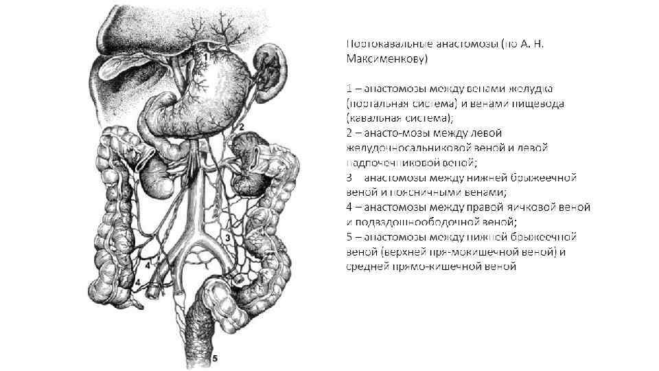 Механизмы нарушения лимфообращения схема