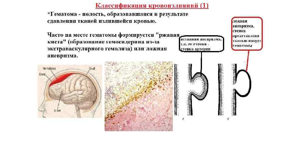 Нарушение кровообращения и лимфообращения патология презентация