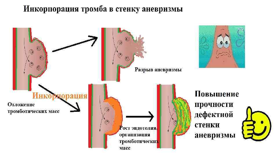 Механизмы нарушения лимфообращения схема