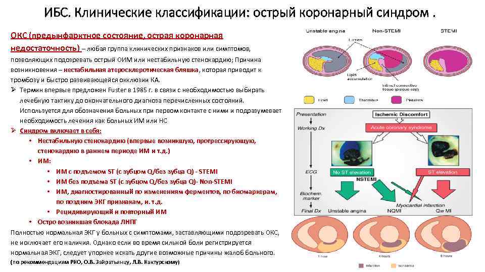 ИБС. Клинические классификации: острый коронарный синдром. ОКС (предынфарктное состояние, острая коронарная недостаточность) – любая