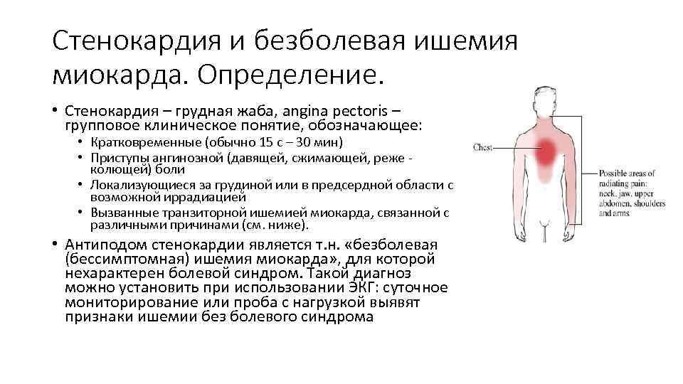 Стенокардия и безболевая ишемия миокарда. Определение. • Стенокардия – грудная жаба, angina pectoris –