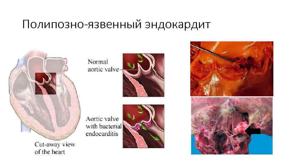 Опухоли патологическая анатомия презентация