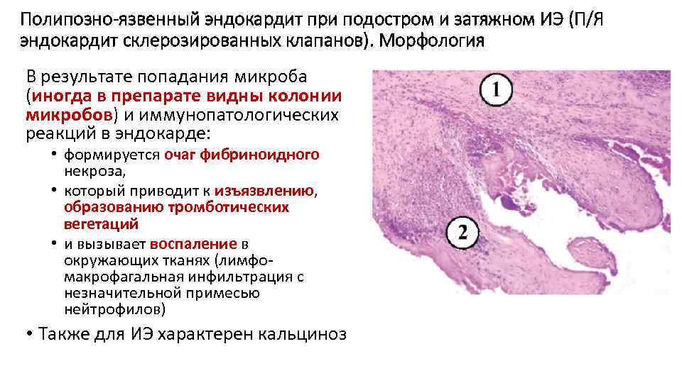 Болезни на тонком плане