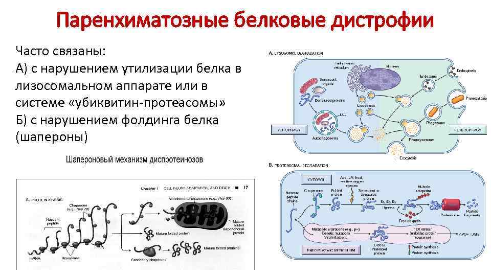Паренхиматозные белковые дистрофии Часто связаны: А) с нарушением утилизации белка в лизосомальном аппарате или