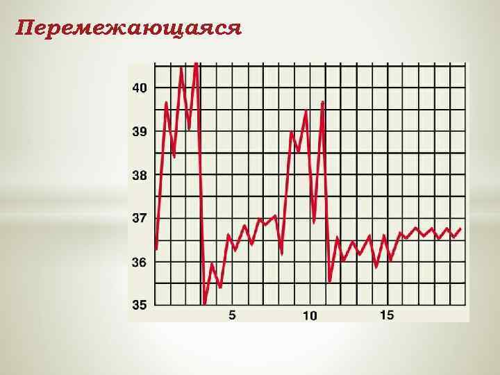 Перемежающаяся 