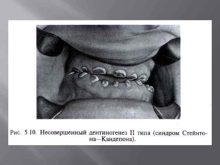 Ифзшоп незавершенный рисунок