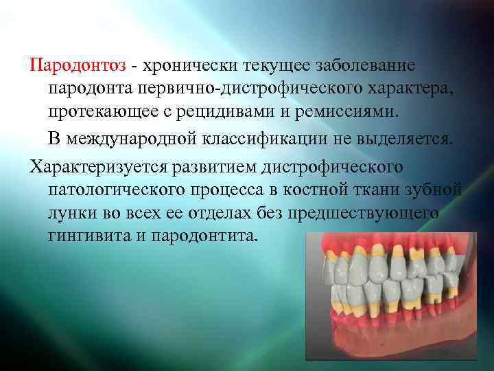 Пародонтоз - хронически текущее заболевание пародонта первично-дистрофического характера, протекающее с рецидивами и ремиссиями. В