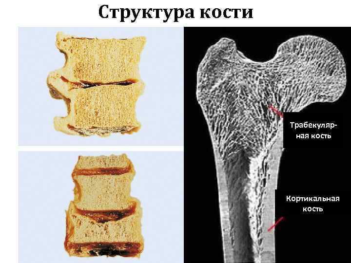 Локальный отек костного мозга