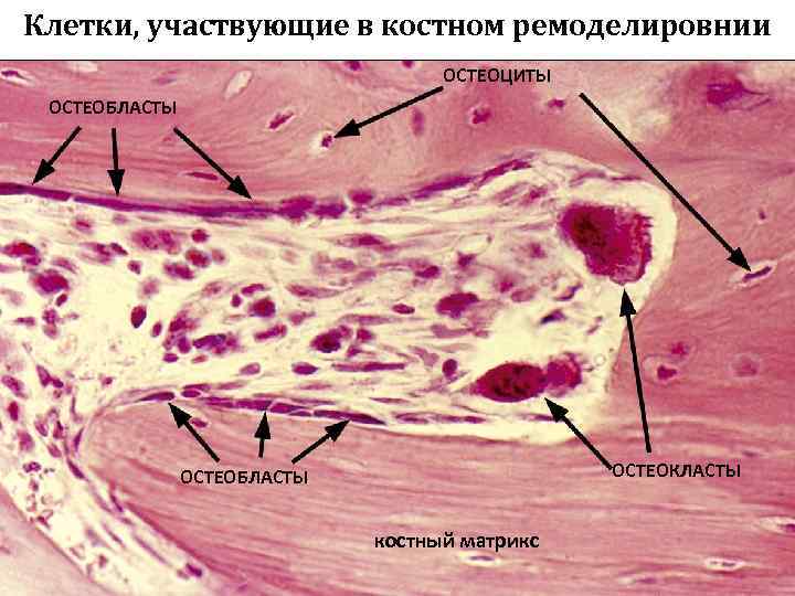 Клетки, участвующие в костном ремоделировнии ОСТЕОЦИТЫ ОСТЕОБЛАСТЫ ОСТЕОКЛАСТЫ ОСТЕОБЛАСТЫ костный матрикс 