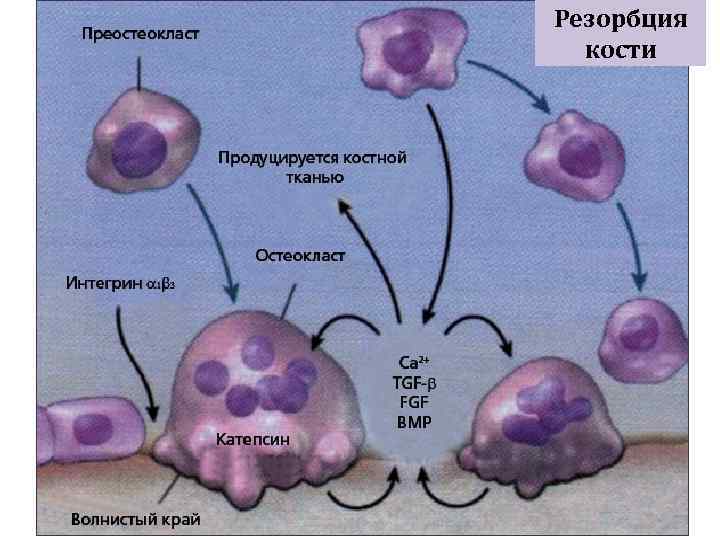 Резорбция кости 