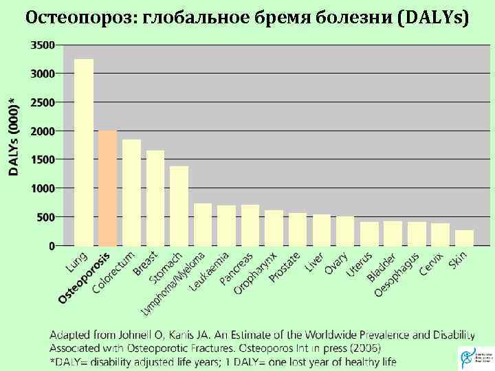 Остеопороз: глобальное бремя болезни (DALYs) Влияние остеопороза на дисабилити 