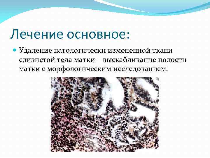 Лечение основное: Удаление патологически измененной ткани слизистой тела матки – выскабливание полости матки с