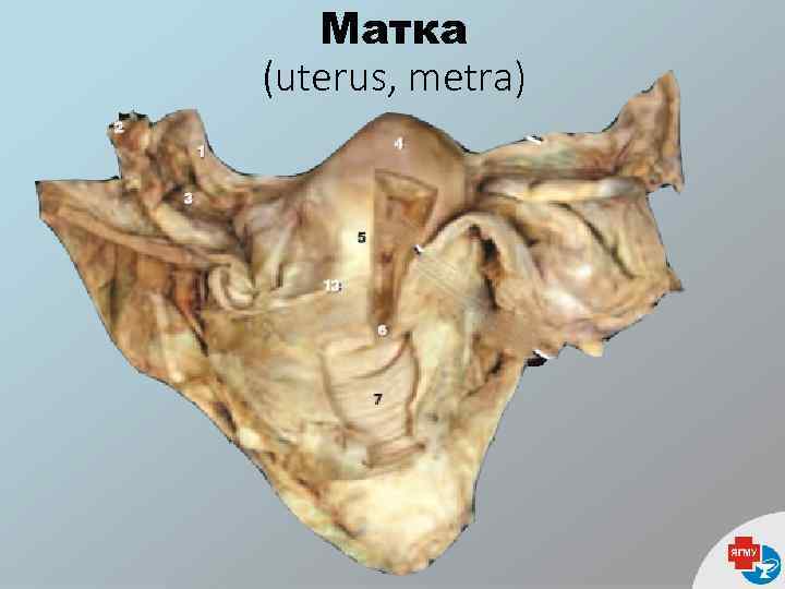 Матка (uterus, metra) 