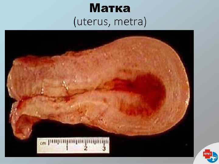 Матка (uterus, metra) 