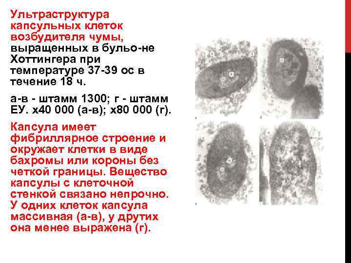Ультраструктура капсульных клеток возбудителя чумы, выращенных в бульо не Хоттингера при температуре 37 39