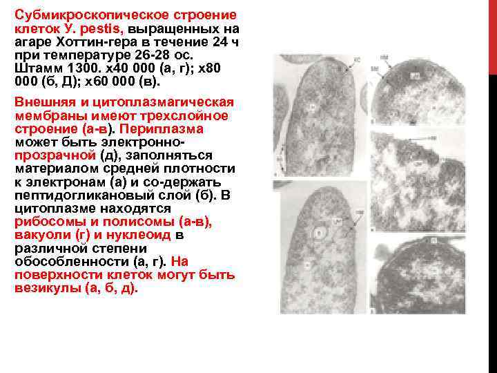 Субмикроскопическое строение клеток У. pestis, выращенных на агаре Хоттин гера в течение 24 ч