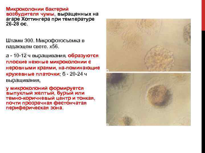 Микроколонии бактерий возбудителя чумы, выращенных на агаре Хоттингера при температуре 26 28 ос. Штамм