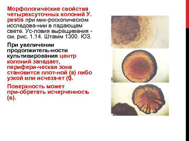 Свойства колонии. Колонии возбудителя чумы. Морфологические свойства колонии. Колонии чумы на плотной среде.