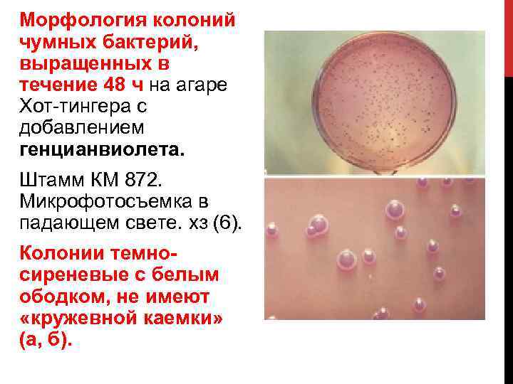 Морфология колоний чумных бактерий, выращенных в течение 48 ч на агаре Хот тингера с