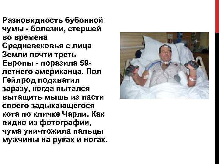 Разновидность бубонной чумы болезни, стершей во времена Средневековья с лица Земли почти треть Европы