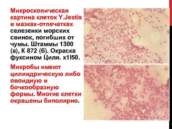 Микроскопическая картина клеток Y. Jestis в мазках отпечатках селезенки морских свинок, погибших от чумы.