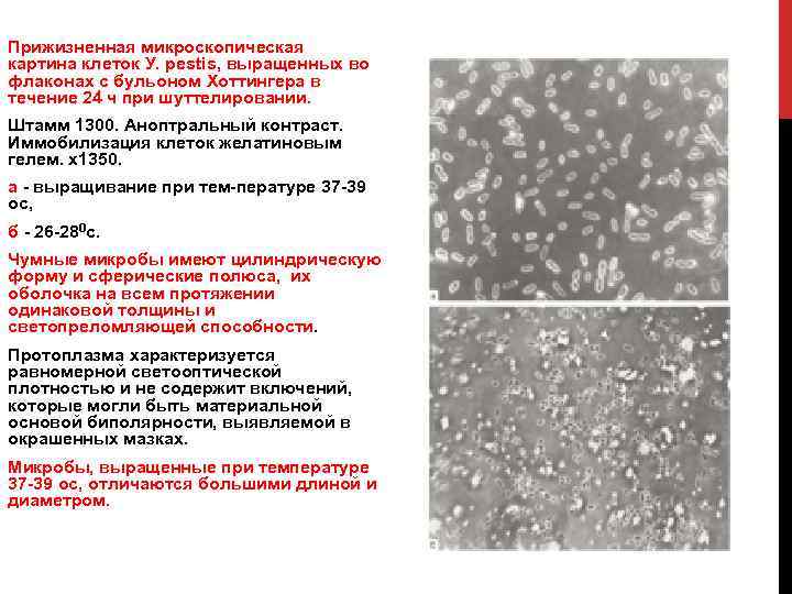 Прижизненная микроскопическая картина клеток У. pestis, выращенных во флаконах с бульоном Хоттингера в течение