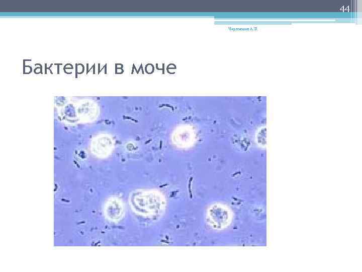 44 Чернышев А. В. Бактерии в моче 