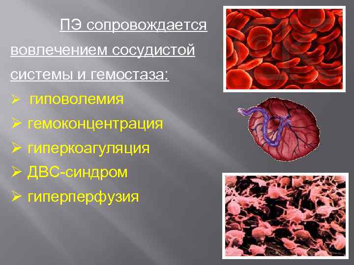 ПЭ сопровождается вовлечением сосудистой системы и гемостаза: Ø гиповолемия Ø гемоконцентрация Ø гиперкоагуляция Ø